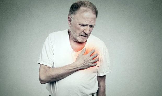 Fragilidad del anciano, nuevo factor de riesgo cardiovascular