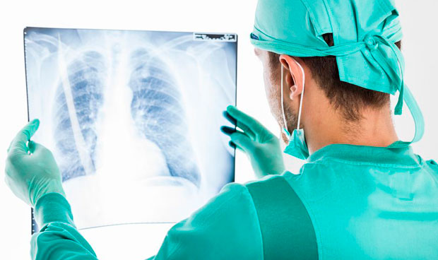 La incidencia del cncer de pulmn crecer un 21% la prxima dcada