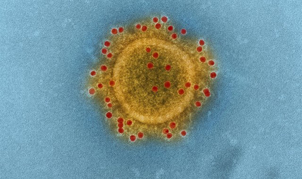 Una encefalitis delata al coronavirus como causa de patología nerviosa