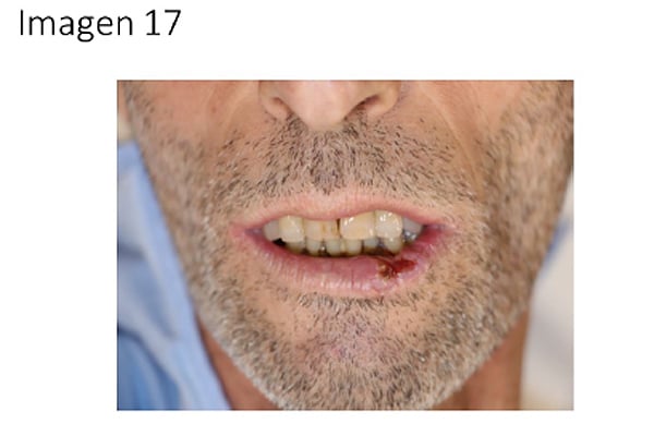 Imagen pregunta 17