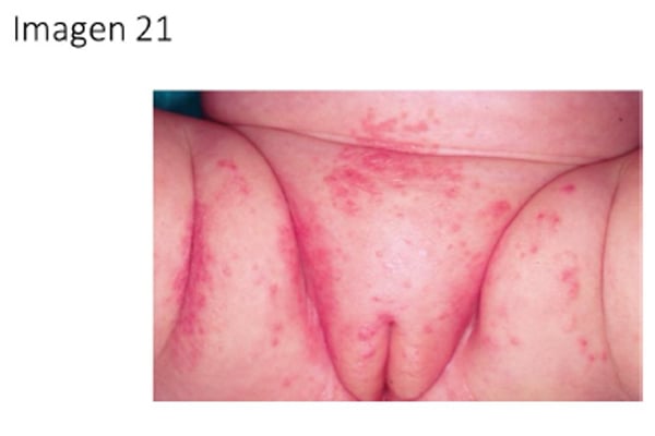 Imagen pregunta 21