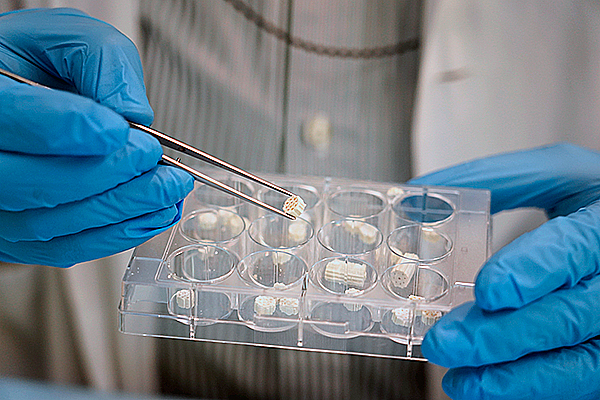 Componentes biomateriales que revolucionan el tratamiento de los defectos óseos.