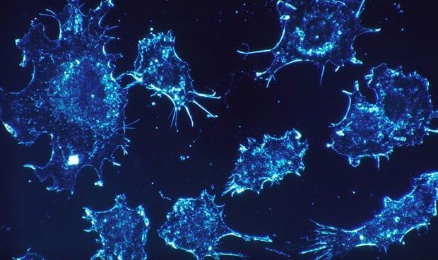 'Canibalismo' entre células cancerosas para hacerse resistentes a la quimio