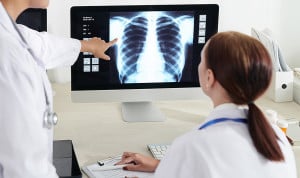 "El cribado de cáncer de pulmón salva vidas y reduce costes al SNS"