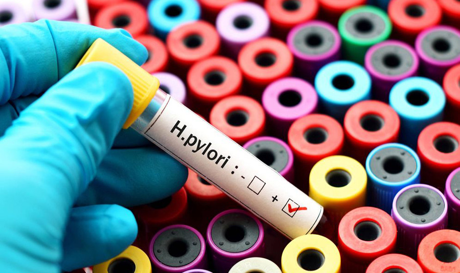 "El diagnóstico precoz es clave para evitar dificultades por Helicobacter"