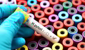 "El diagnóstico precoz es clave para evitar dificultades por Helicobacter"