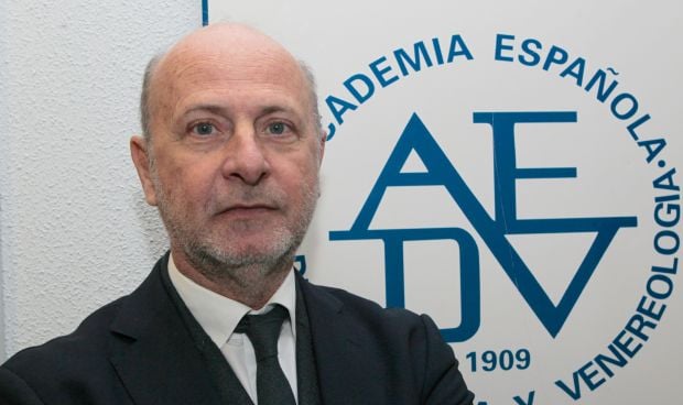  El número de españoles con psoriasis equivale a la población de Asturias