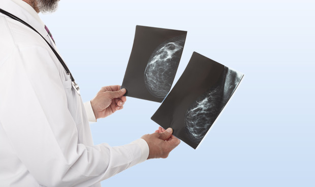 Los radiólogos y su papel fundamental en los cribados de cáncer de mama. 