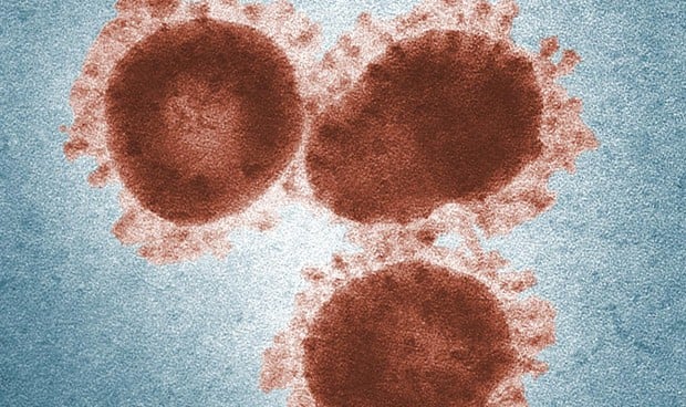 Coronavirus: "El riesgo en España es bajo" y "es menos mortal que el ébola"