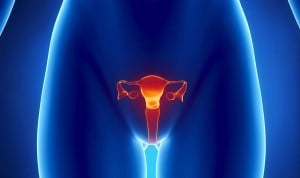 ¿Protegen los microorganismos vaginales contra el cáncer de cérvix?