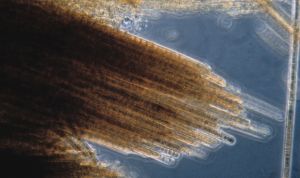 ¿Provocan tumores las microalgas de las playas canarias?