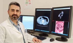 "Radiología desempeña un papel crucial en el manejo del cáncer colorrectal"