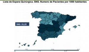 Entre 42 y 269 días: lo que debes esperar para ser operado en cada CCAA 