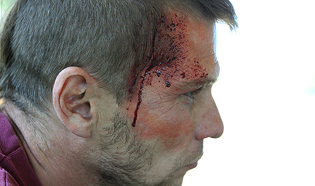 Enfermería recrea un atentado con droga caníbal, armas y caos en el tráfico