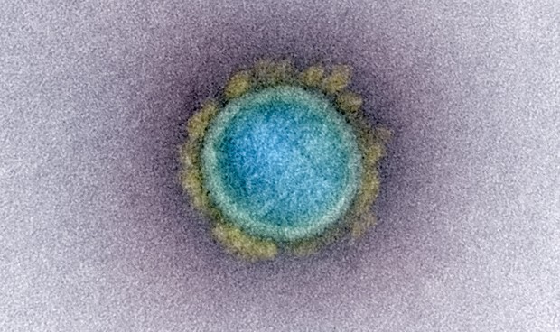 Coronavirus: la pandemia a través de sus imágenes más significativas