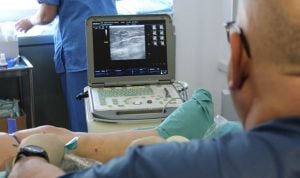 Albacete implanta una nueva técnica para tratar las varices sin cirugía