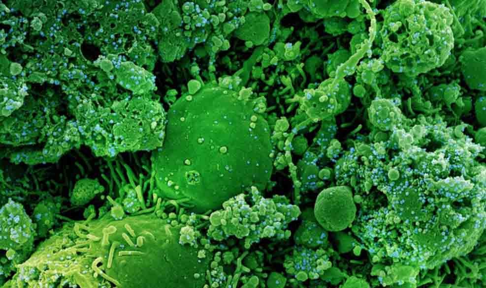 Alemania desarrolla una proteína que impide la infección por coronavirus