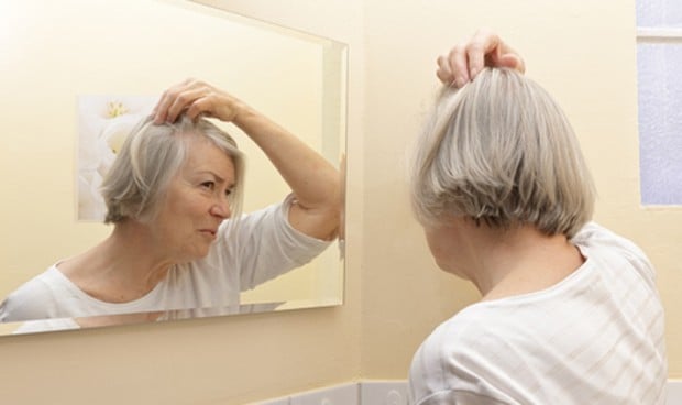 Asocian un tipo de alopecia en mujeres con estados inflamatorios