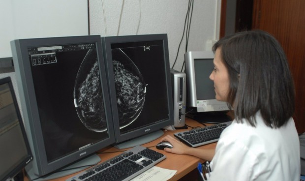 El SAS implanta un sistema de información centralizado para la detección precoz del cáncer de mama