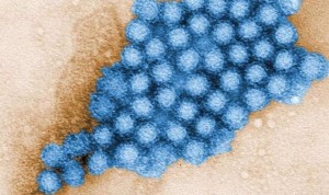 Andalucía confirma un norovirus como culpable del brote gastrointestinal