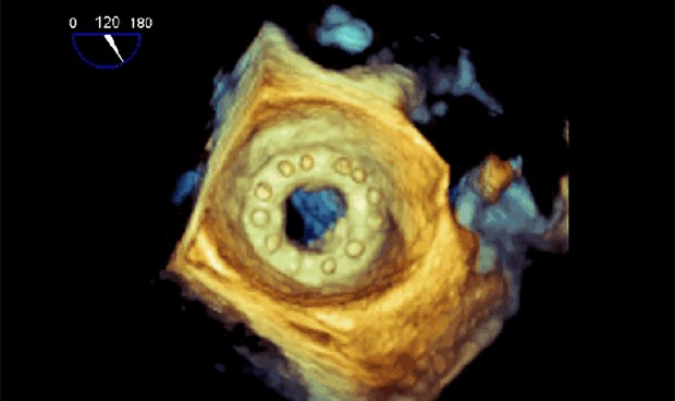 Así es la tecnología 3D para ‘resucitar’ corazones antes del quirófano