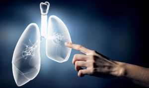 Así lucha el sistema inmune del pulmón contra la tuberculosis