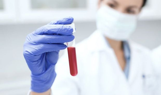 Avances hacia la deteccin del cncer de pncreas con un anlisis de sangre