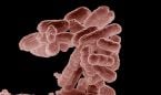 Cada a�o 1,8 millones de j�venes de todo el mundo desarrolla tuberculosis