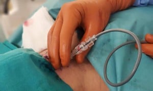 Canarias incorpora una técnica pionera para tratar hernias cervicales
