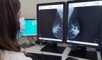 El microambiente óseo reduce la metástasis del cáncer de mama