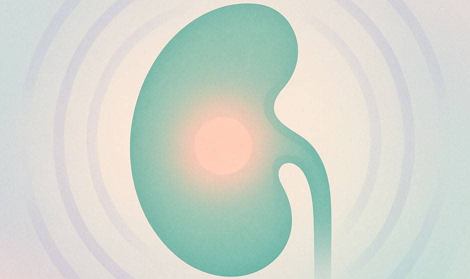 Cada año se diagnostican en España cerca de 10.000 nuevos casos de cáncer de riñón