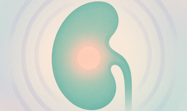 Cada año se diagnostican en España cerca de 10.000 nuevos casos de cáncer de riñón