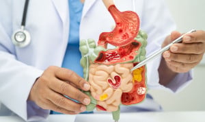 Carne roja: enemigo de la longevidad que desata inflamación en el intestino