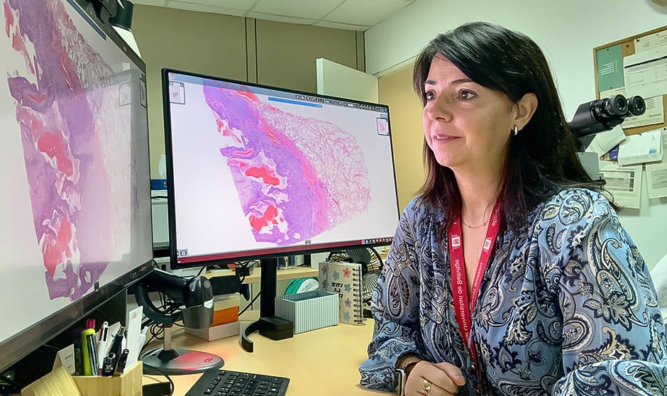 La patóloga Lara Pijuan formará parte de la nueva red de hospitales para digitalizar patologías