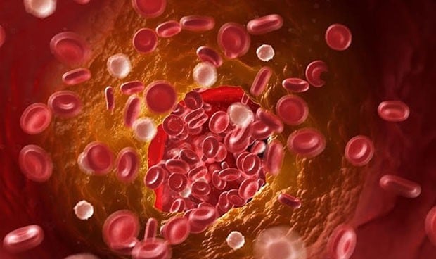 Células mutantes se unen para producir un cáncer de sangre más mortal