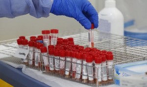 ¿Cómo esquivan la inmunidad las variantes Covid británica y sudafricana?