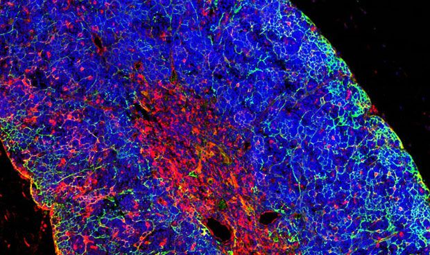 Científicos españoles 'crean' leucemia a partir de células sanas