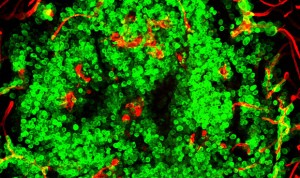 CNIO crea una plataforma colaborativa para estudiar la metástasis cerebral