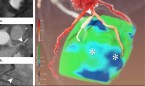 Combinan TAC y resonancia en 3D para diagnosticar enfermedades coronarias