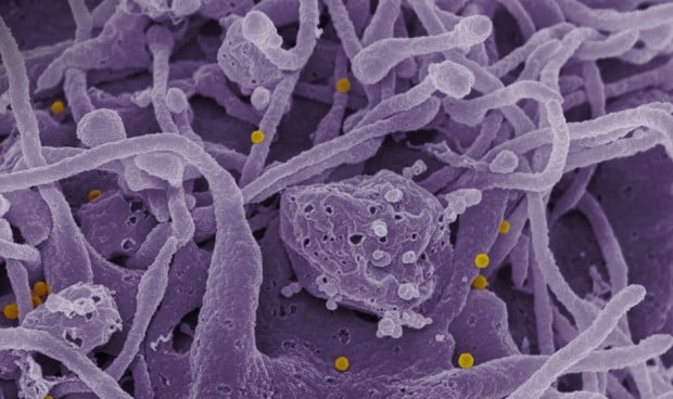 Confirmado un caso de fiebre hemorrágica de Crimea-Congo en Castilla y León