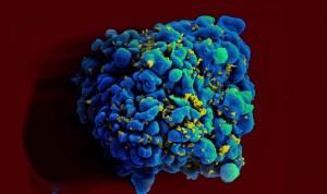 Confirman la segunda curación de VIH del mundo