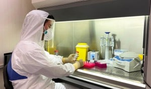 Coronavirus: Ascires diseña un test que permite hacer 7.000 pruebas diarias