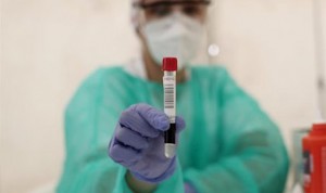Coronavirus: España suma más de 3 millones de pruebas diagnósticas PCR