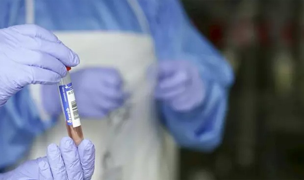 Coronavirus: España, octavo país de la OCDE que más PCR realiza