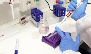 Coronavirus: Galicia asegura que los test rápidos "no son de diagnóstico"