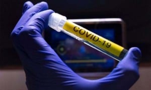 Coronavirus: inmunidad durante años "e incluso décadas" en quienes lo pasan