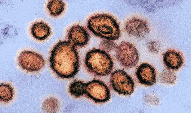 Coronavirus| "No es menos virulento ni ha mutado, solo hay casos más leves"