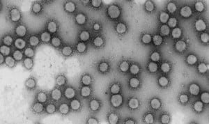 Un solo genotipo del coronavirus causó el 60% de casos Covid-19 en marzo