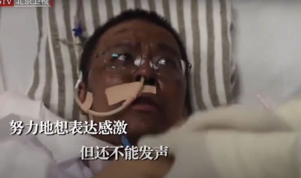 Coronavirus: muere el médico chino que despertó del coma con la piel negra
