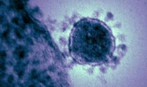 Coronavirus: España pasa la barrera de las 100 muertes con 4.231 positivos